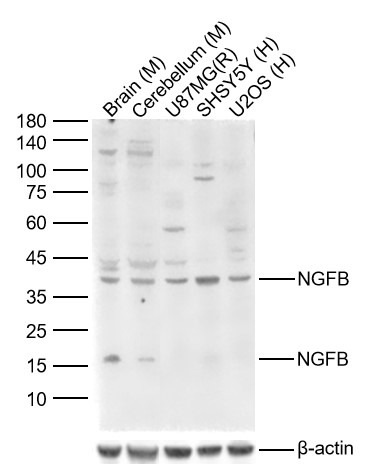 Anti-NGF Polyclonal Antibody