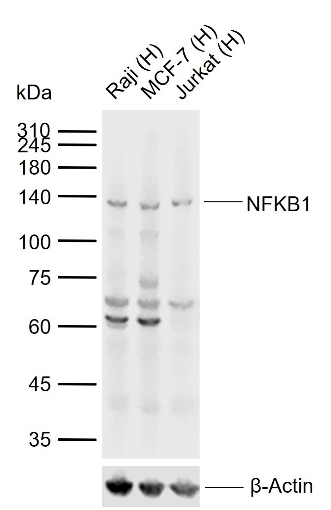 Anti-NFKB1 Polyclonal Antibody