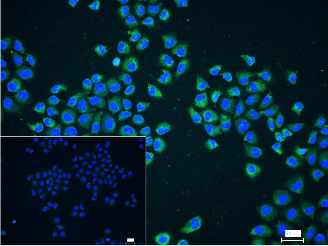 Anti-NF-kB p65 Antibody (2I809)
