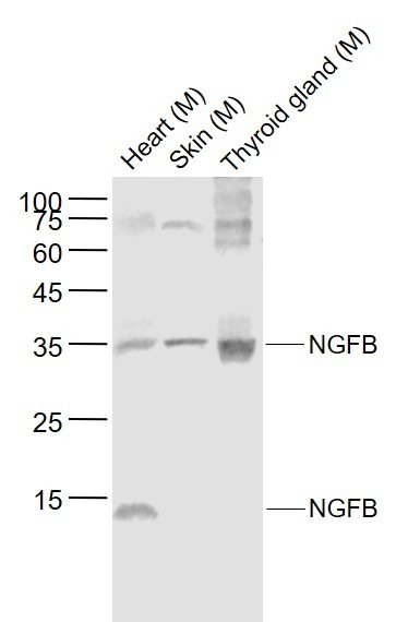 Anti-NGF Polyclonal Antibody 2