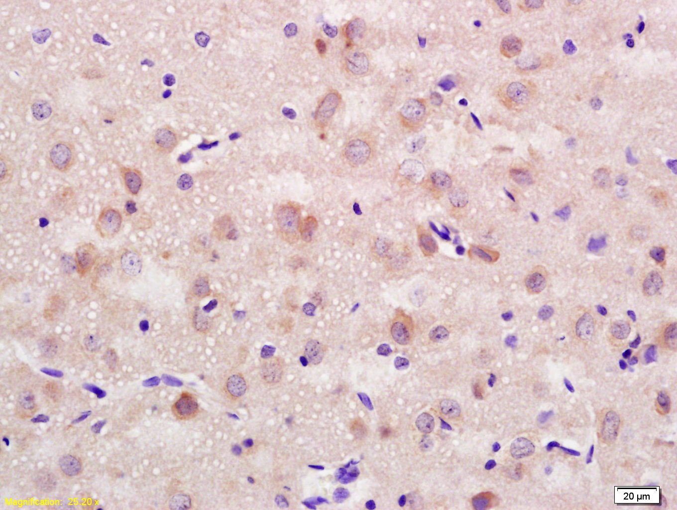 Anti-NCAM1 Polyclonal Antibody 2