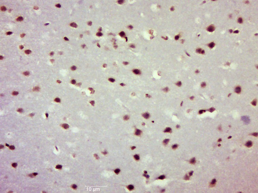 Anti-NFKB1 Polyclonal Antibody