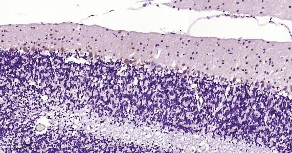 Anti-NGF Antibody (1M564)