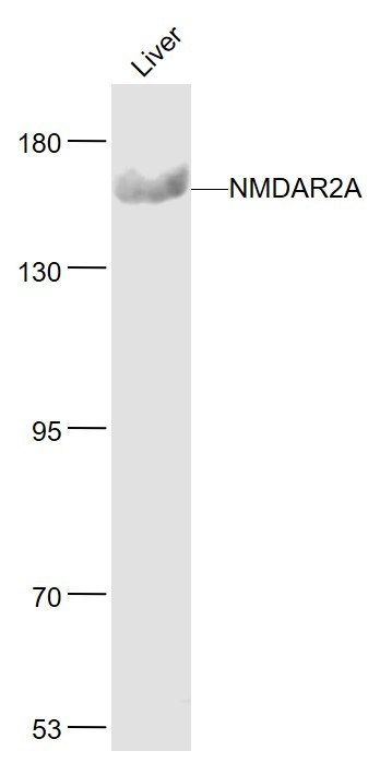 Anti-NMDAR2A Polyclonal Antibody
