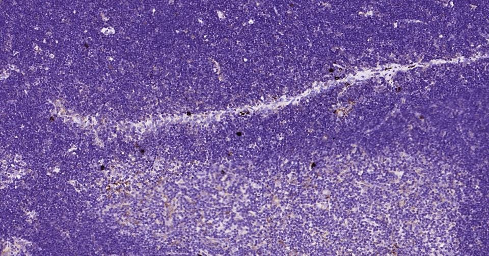 Anti-NLRP3 Polyclonal Antibody