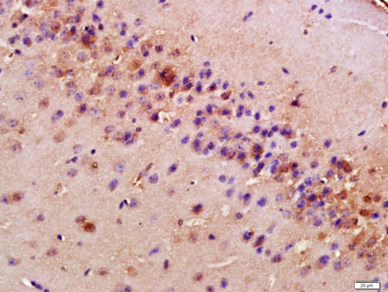 Anti-Nitro-Alpha-synuclein (Tyr39) Polyclonal Antibody