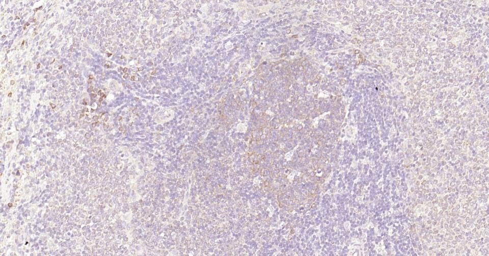 Anti-NF-kB p65 Antibody (2I809)