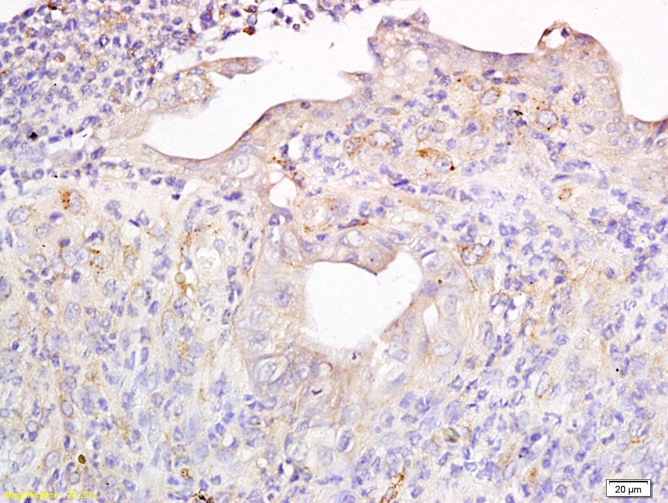 Anti-MT2A Polyclonal Antibody