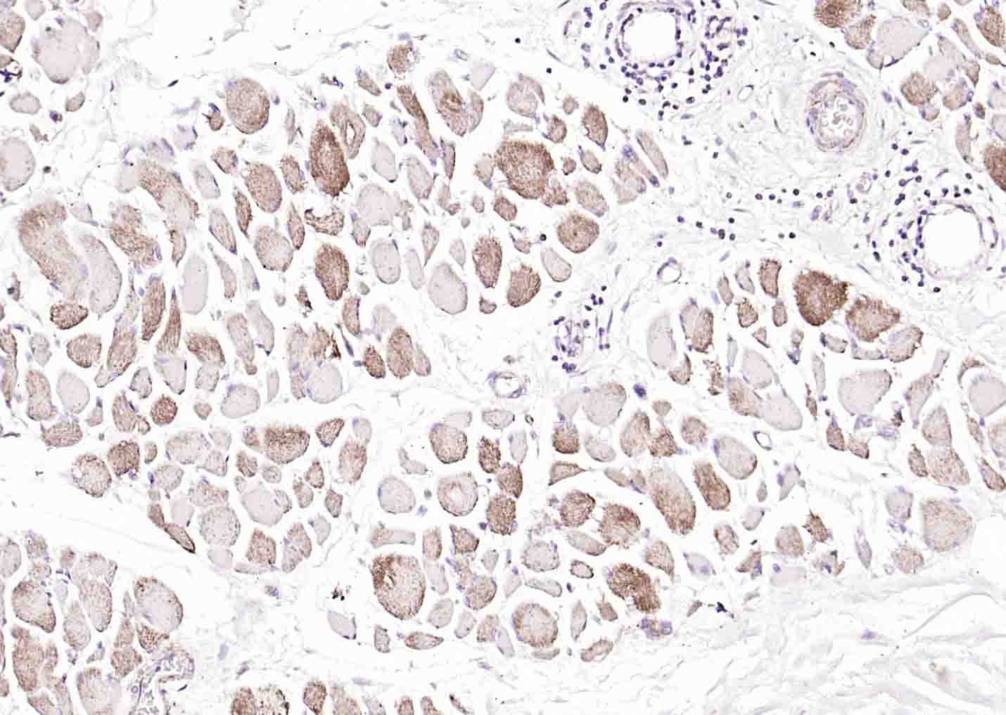 Anti-Osteocalcin Polyclonal Antibody 2