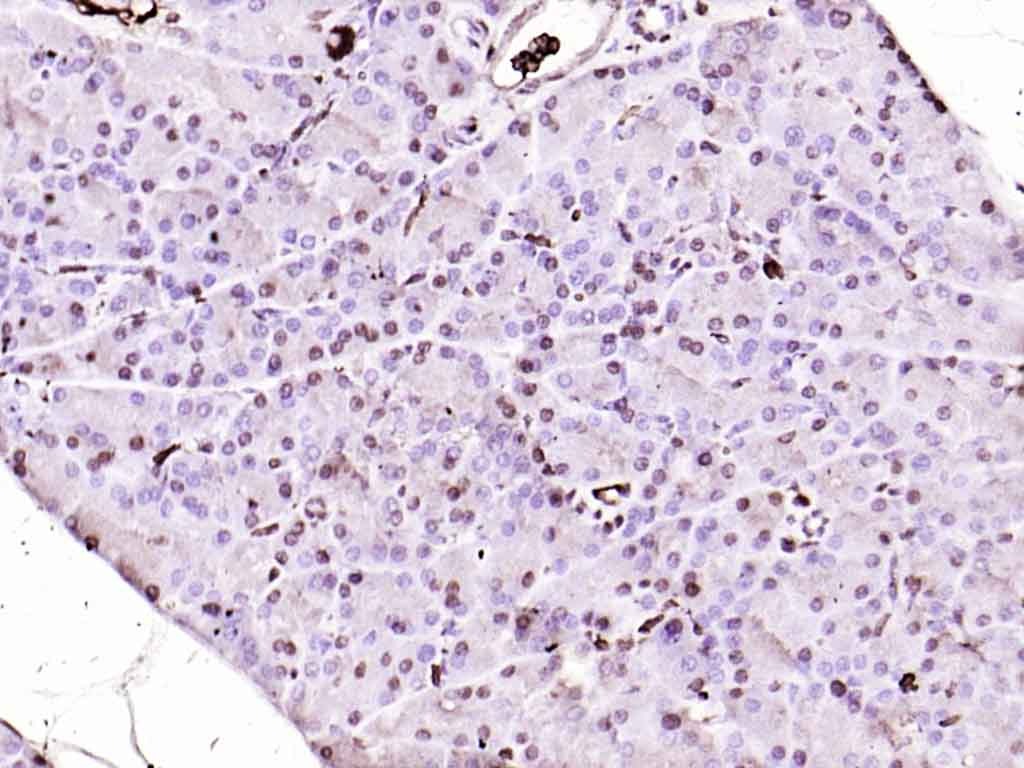 Anti-MT2A Polyclonal Antibody