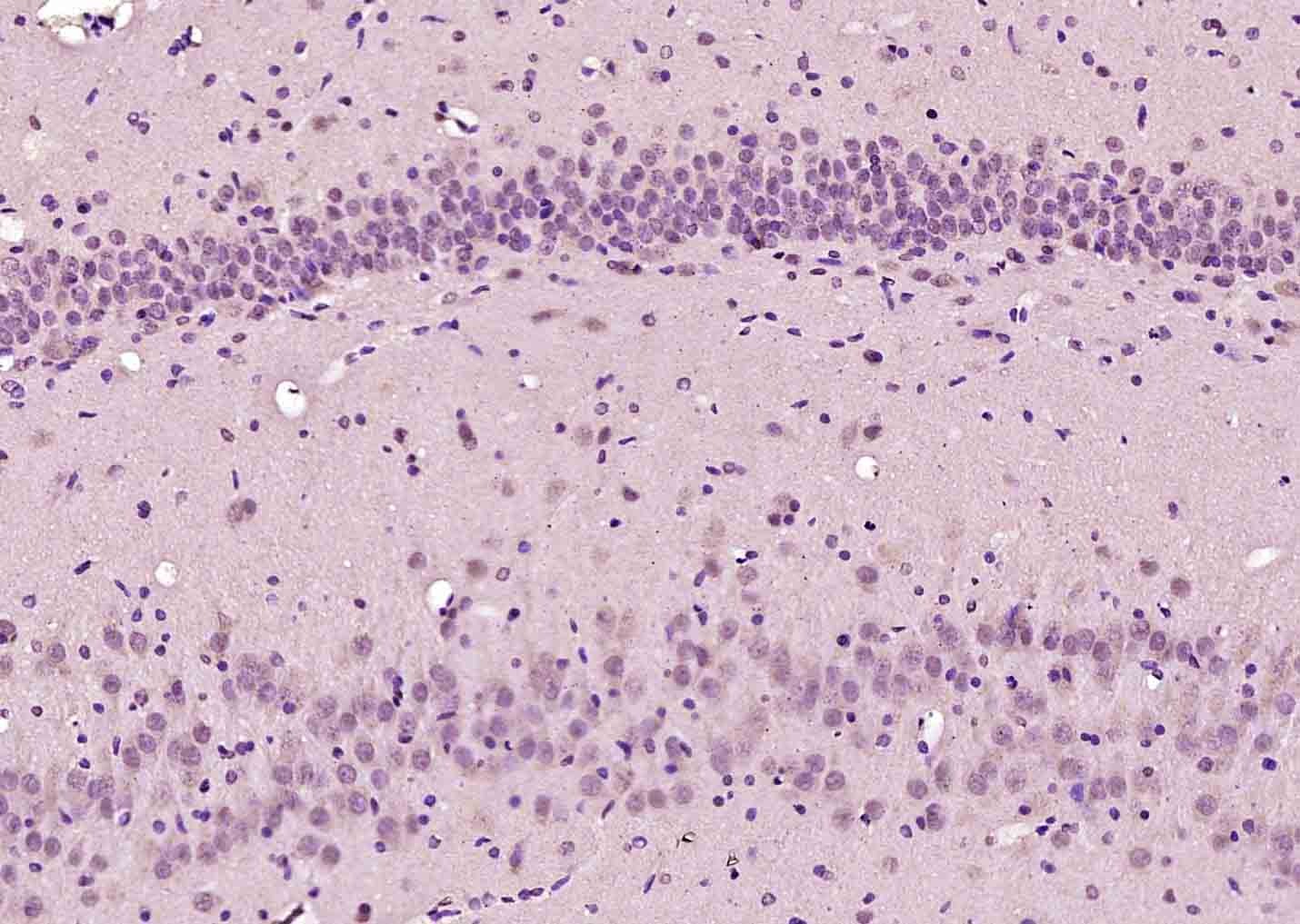 Anti-MSGN1 Polyclonal Antibody