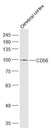 Anti-NCAM1 Polyclonal Antibody 2