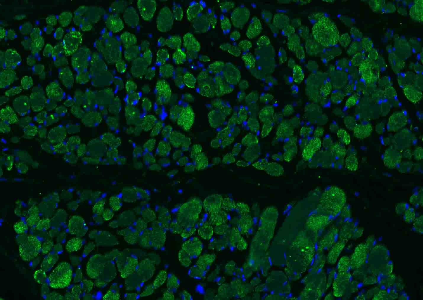 Anti-Osteocalcin Polyclonal Antibody 2
