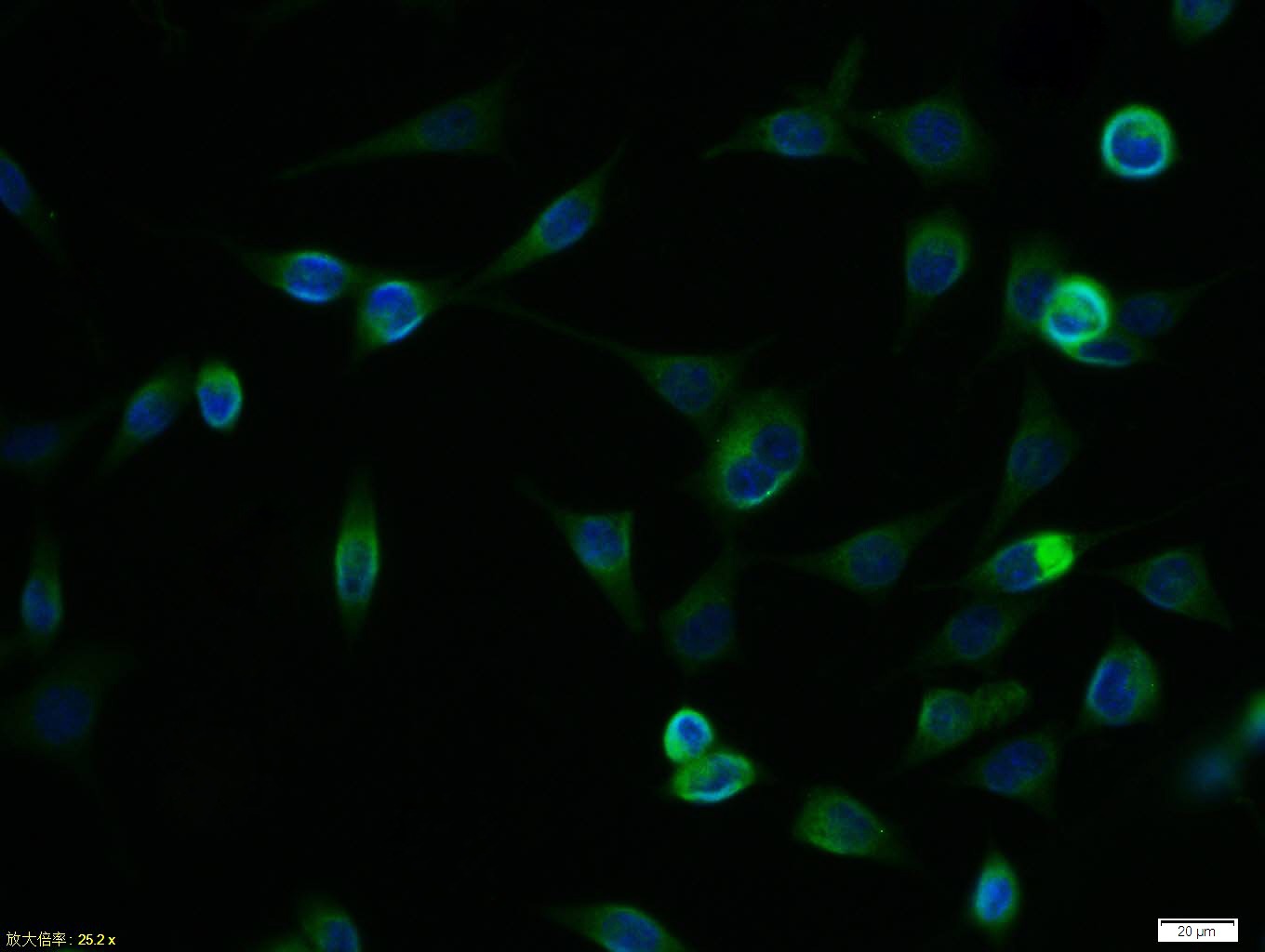 Anti-NCAM1 Polyclonal Antibody 2