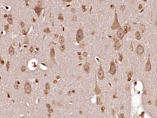 Anti-MT-ND6 Polyclonal Antibody