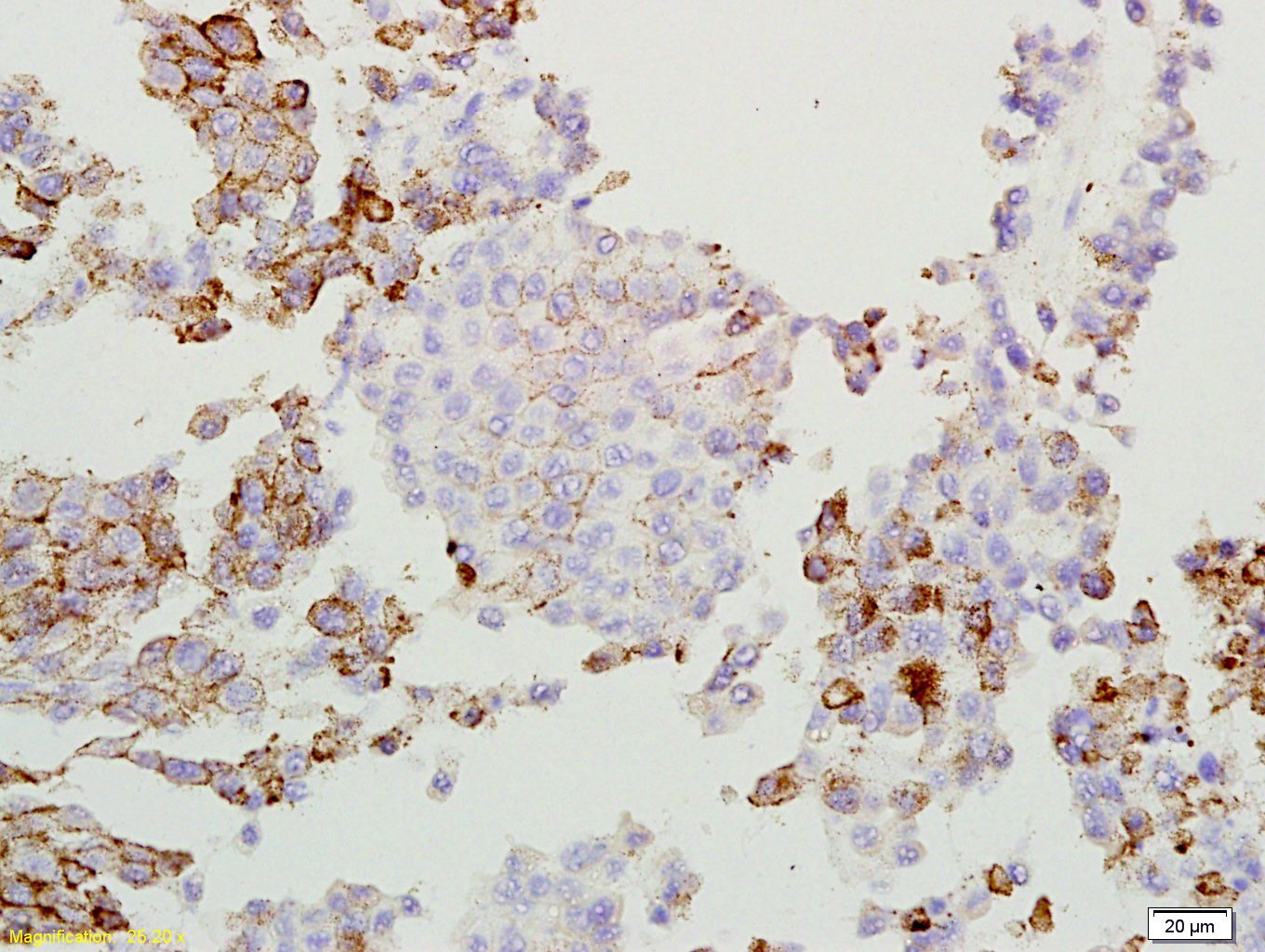 Anti-Osteoactivin/GPNMB Polyclonal Antibody