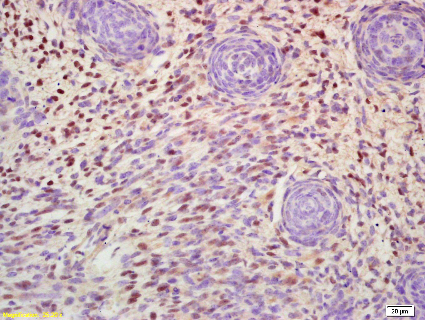Anti-MSX1 Polyclonal Antibody