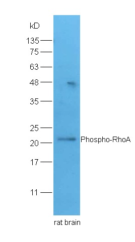 Anti-Phospho-RhoA (Ser188) Polyclonal Antibody