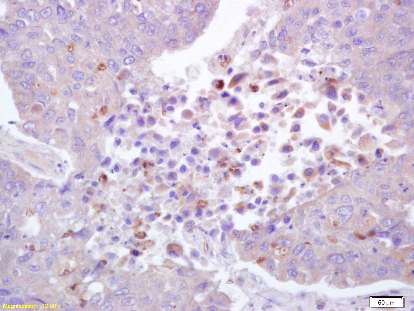 Anti-Phospho-ROCK1 (Thr455, Ser456) Polyclonal Antibody
