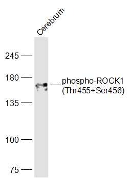 Anti-Phospho-ROCK1 (Thr455, Ser456) Polyclonal Antibody