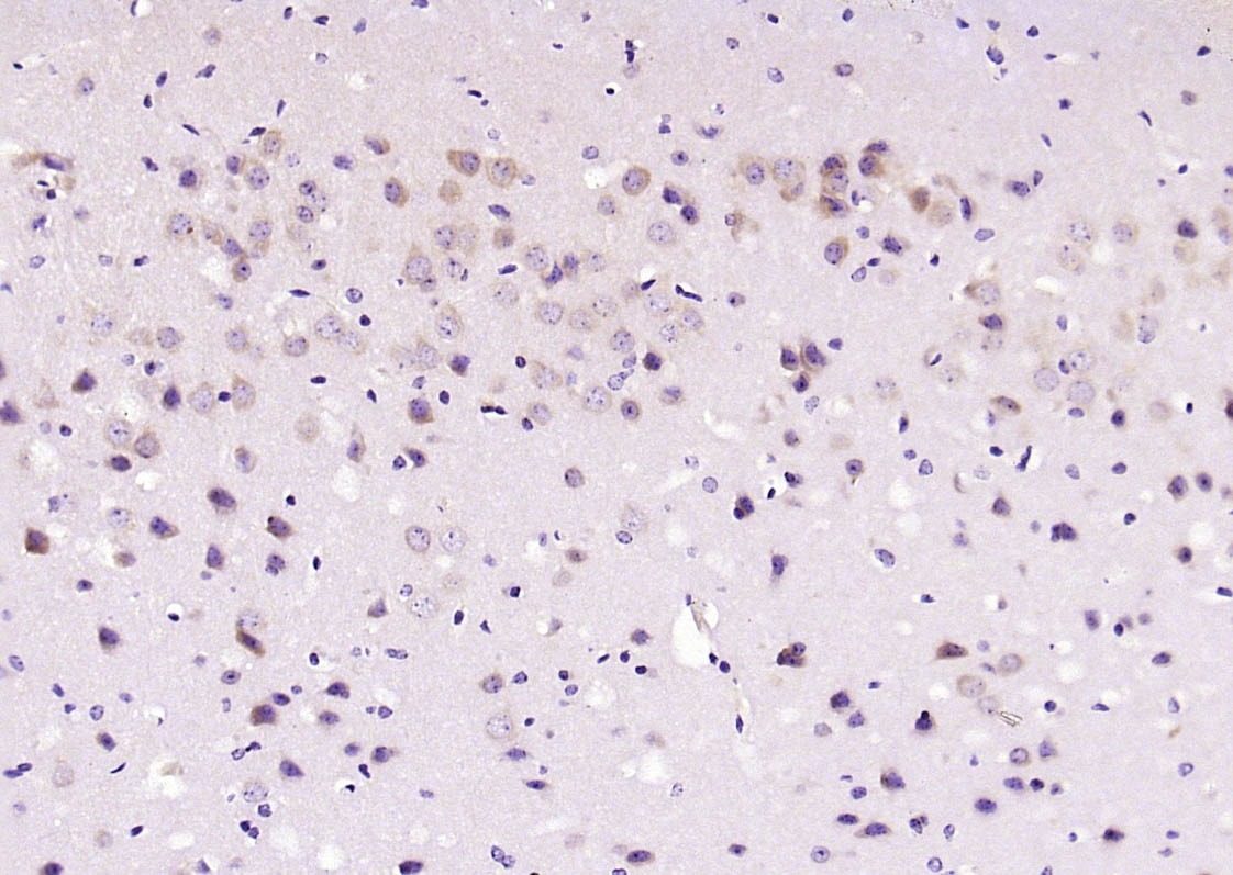Anti-Phospho-JNK1/2/3 (Thr 183, Tyr185) Polyclonal Antibody