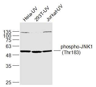 Anti-Phospho-JNK1 (Thr183) Polyclonal Antibody