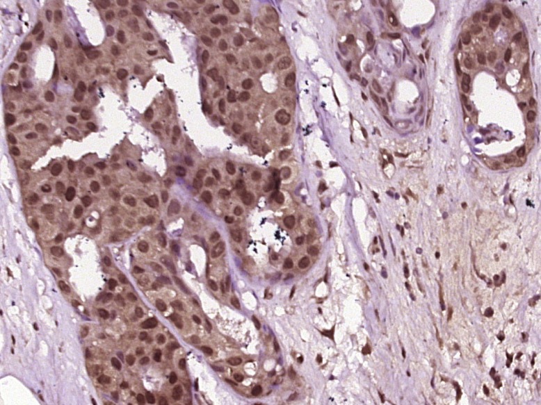 Anti-Phospho-JNK1/2/3 (Thr 183, Tyr185) Polyclonal Antibody