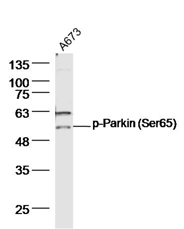 Anti-Phospho-PRKN (Ser65) Polyclonal Antibody