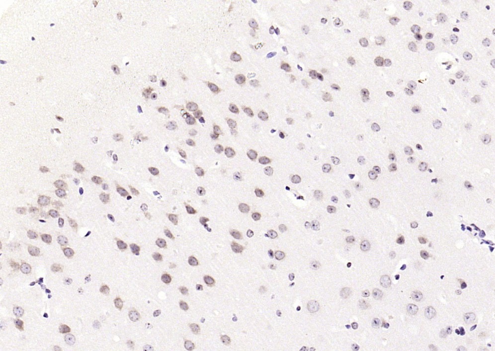 Anti-Phospho-JNK1/2/3 (Thr 183, Tyr185) Polyclonal Antibody