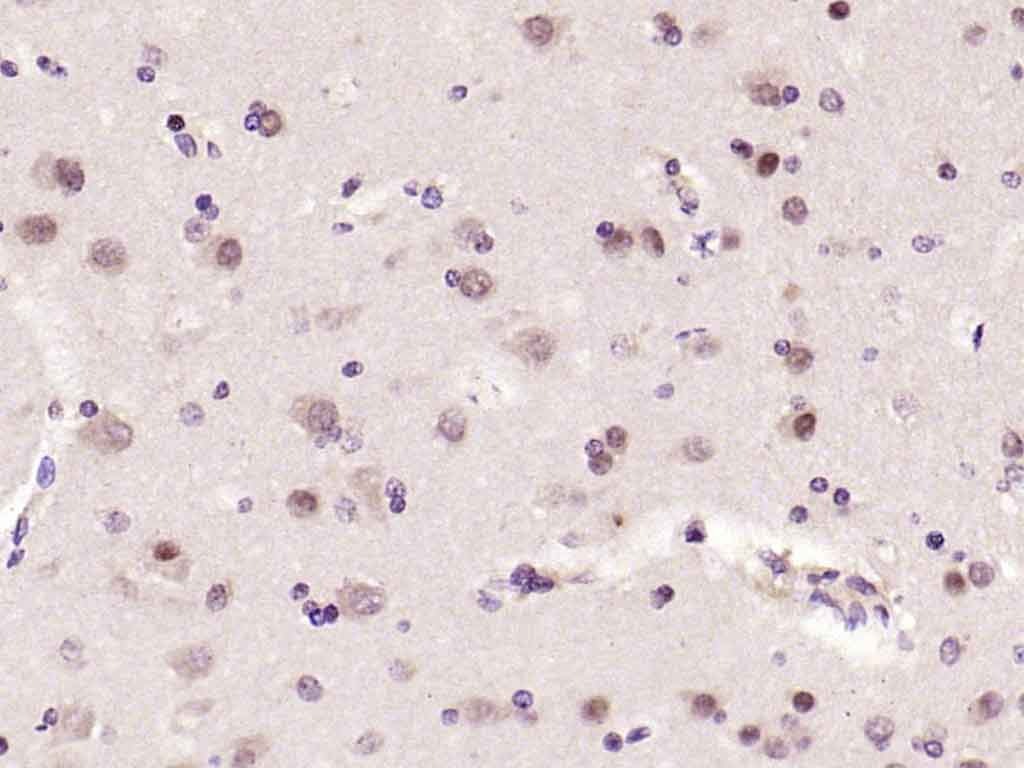 Anti-Phospho-JNK1/2/3 (Thr 183, Tyr185) Polyclonal Antibody