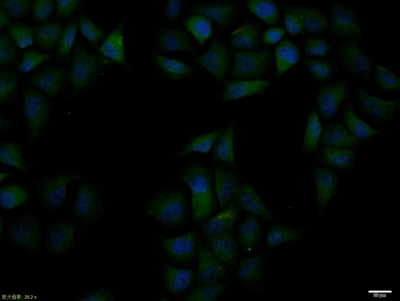 Anti-Phospho-JAK2 (Tyr221) Polyclonal Antibody