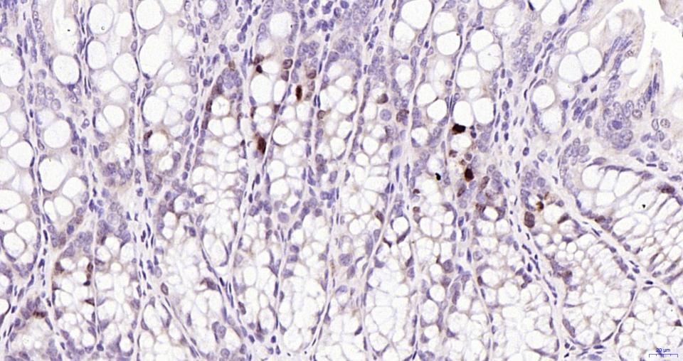 Anti-Phospho-JNK1/2/3 (Thr 183, 183, 221) Antibody (2H865)
