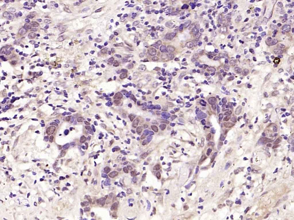 Anti-Phospho-JNK1/2/3 (Thr 183, Tyr185) Polyclonal Antibody