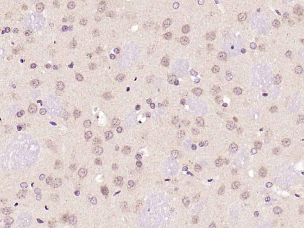 Anti-Phospho-JNK1/2/3 (Thr 183, Tyr185) Polyclonal Antibody