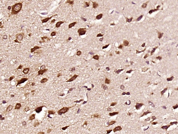 Anti-Phospho-JNK1/2/3 (Thr 183, 183,  221) Polyclonal Antibody
