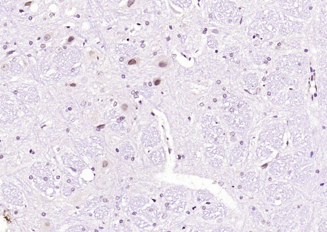 Anti-Phospho-JNK1/2/3 (Thr 183, Tyr185) Polyclonal Antibody