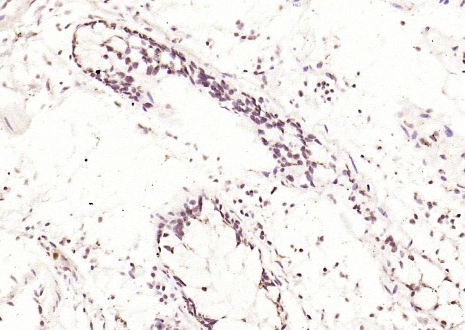 Anti-Phospho-JNK1/2/3 (Thr 183, Tyr185) Polyclonal Antibody