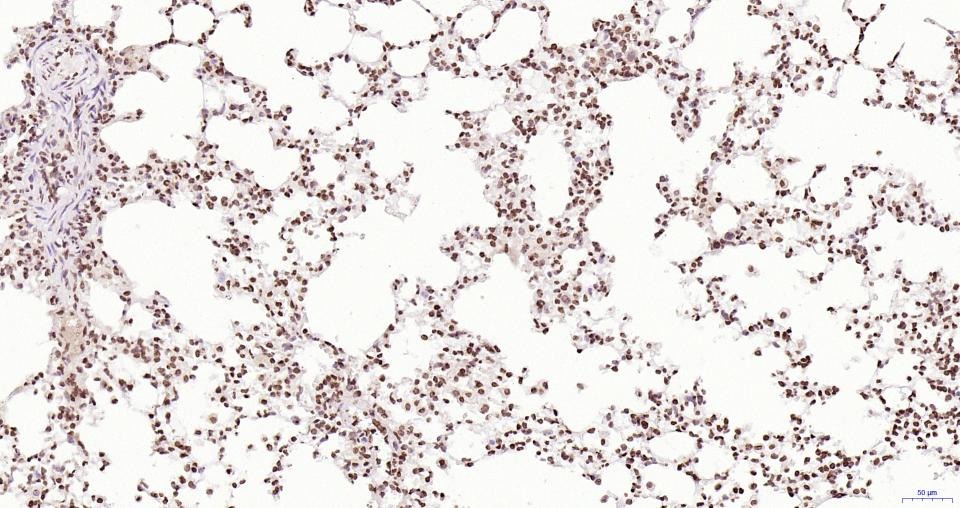 Anti-Phospho-JAK2 (Tyr1007, 1008) Antibody (2X102)