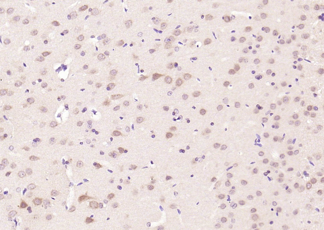 Anti-Phospho-JNK1/2/3 (Thr 183, 183,  221) Polyclonal Antibody