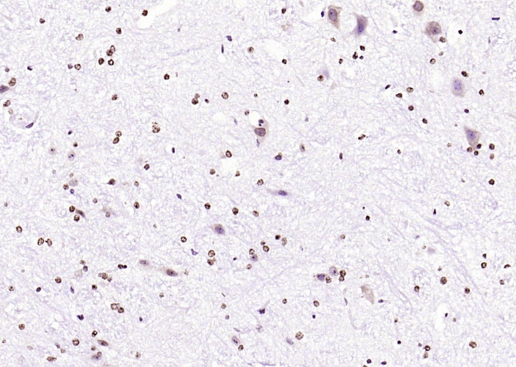 Anti-Phospho-JNK1/2/3 (Thr 183, Tyr185) Polyclonal Antibody