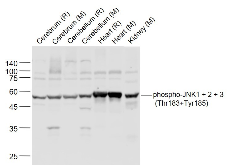 Anti-Phospho-JNK1/2/3 (Thr 183, Tyr185) Polyclonal Antibody