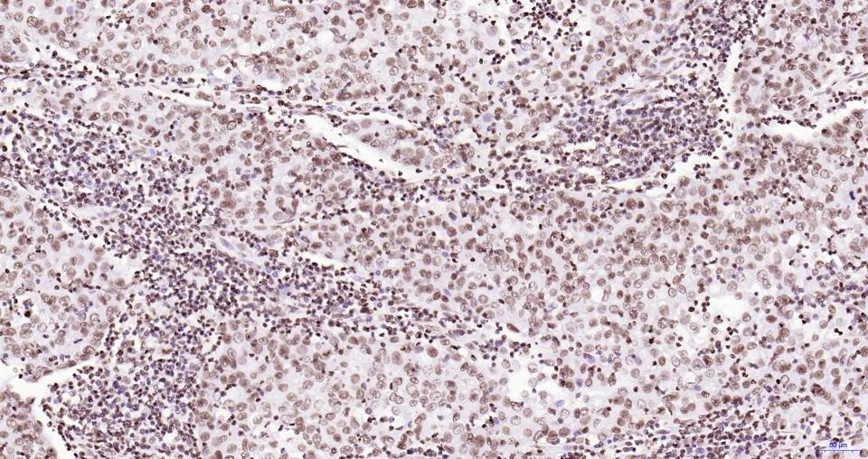 Anti-Phospho-JAK2 (Tyr1007, 1008) Antibody (2X102)