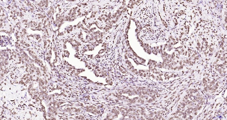 Anti-Phospho-JAK2 (Tyr1007, 1008) Antibody (2X102)