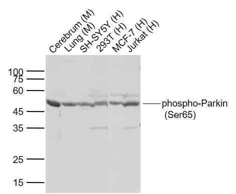 Anti-Phospho-PRKN (Ser65) Polyclonal Antibody