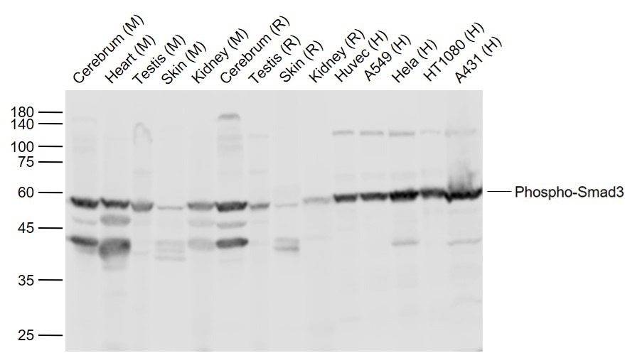 Anti-Phospho-Smad1/5 (Ser463, 465) Polyclonal Antibody