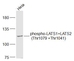 Anti-Phospho-LATS1/2 (Thr1079, 1041) Polyclonal Antibody