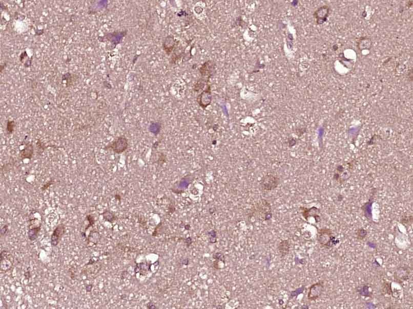 Anti-Phospho-Serine/Threonine Polyclonal Antibody