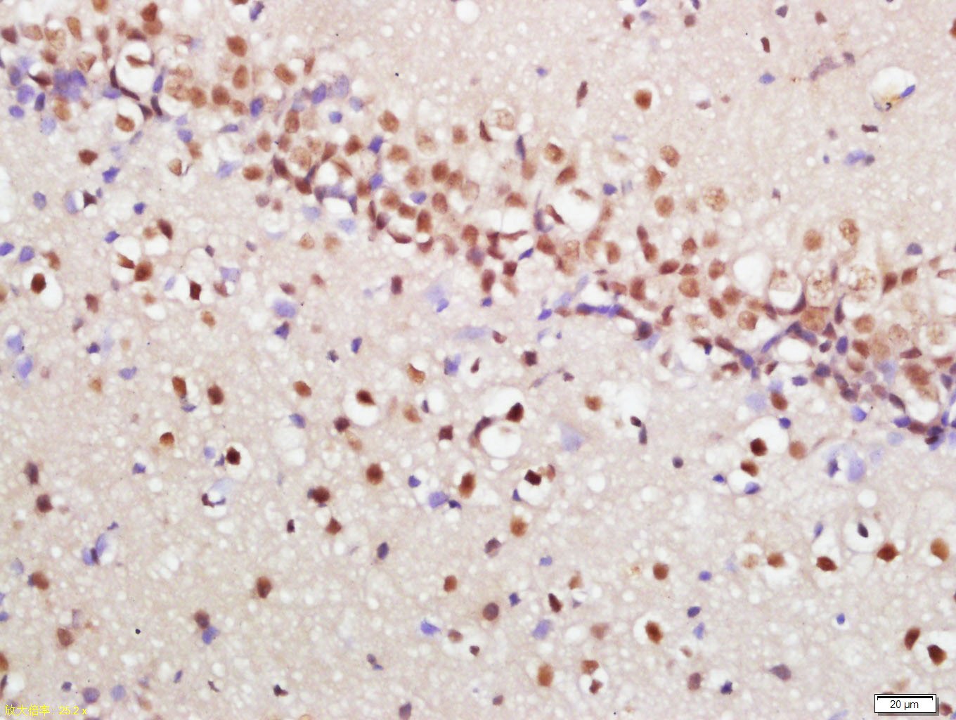 Anti-Phospho-mTOR (Ser2448) Polyclonal Antibody