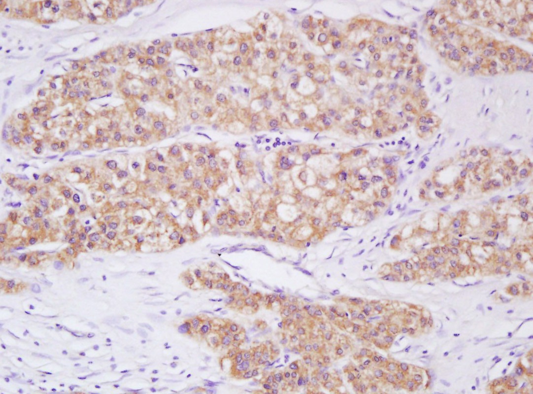 Anti-Phospho-Smad3 (Ser423, Ser425) Polyclonal Antibody