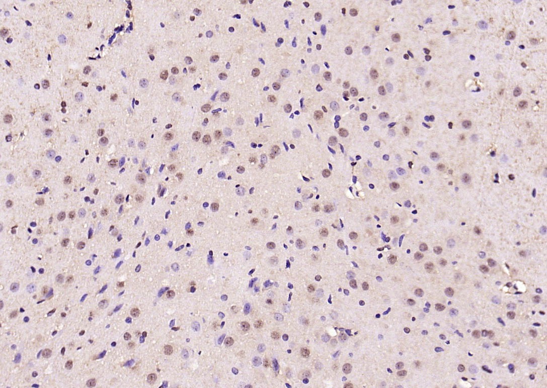 Anti-Phospho-Smad3 (Ser423, Ser425) Polyclonal Antibody